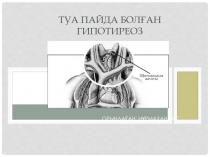 Туа пайда болған гипотиреоз