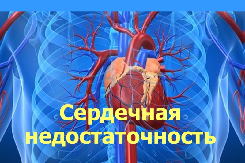 Сердечная
недостаточность