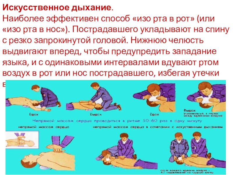 Искусственное дыхание картинки для презентации