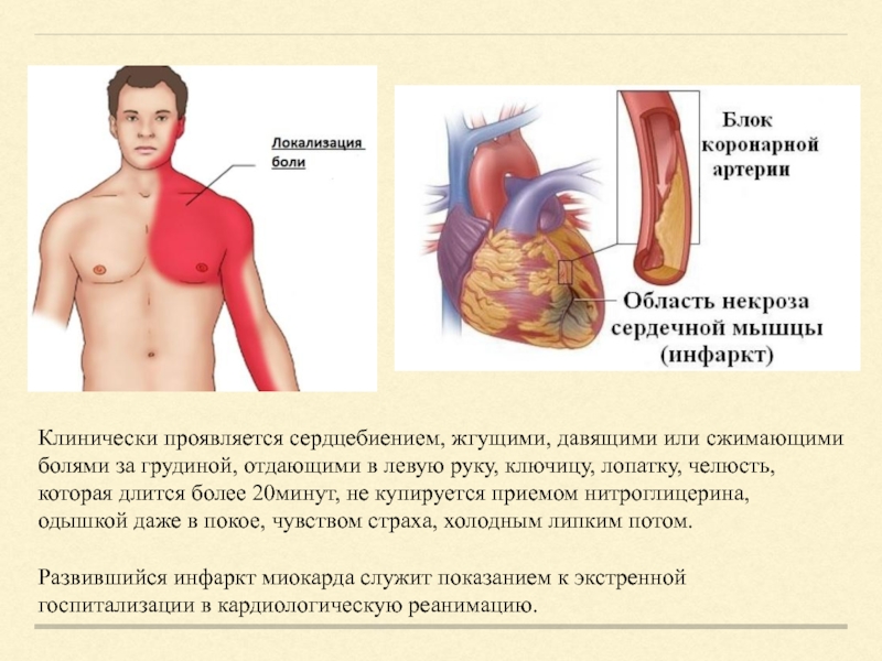 Ишемическая болезнь сердца презентация на английском языке