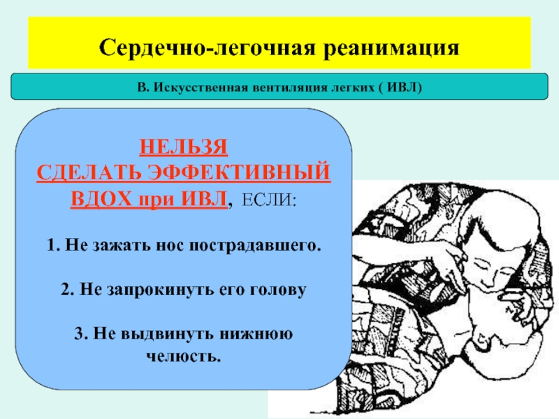 Искусственная легочная реанимация. Сердечно легочная реанимация искусственная вентиляция легких. Сердечно-легочная реанимация ИВЛ. СЛР искусственная вентиляция легких. ИВЛ реанимация пострадавшего.