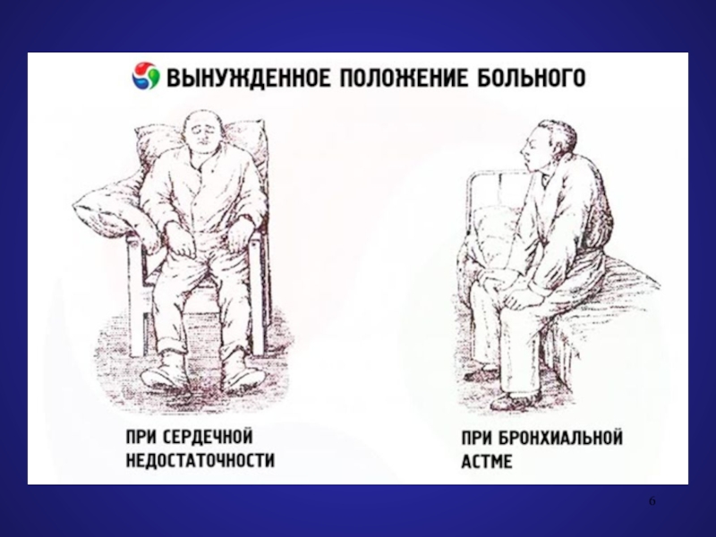 Активное положение. Вынужденное положение больного при сердечной недостаточности. Вынужденное положение пациента при приступе бронхиальной астмы. Вынужденное положение больного при приступе бронхиальной астмы. Вынужденное положение.