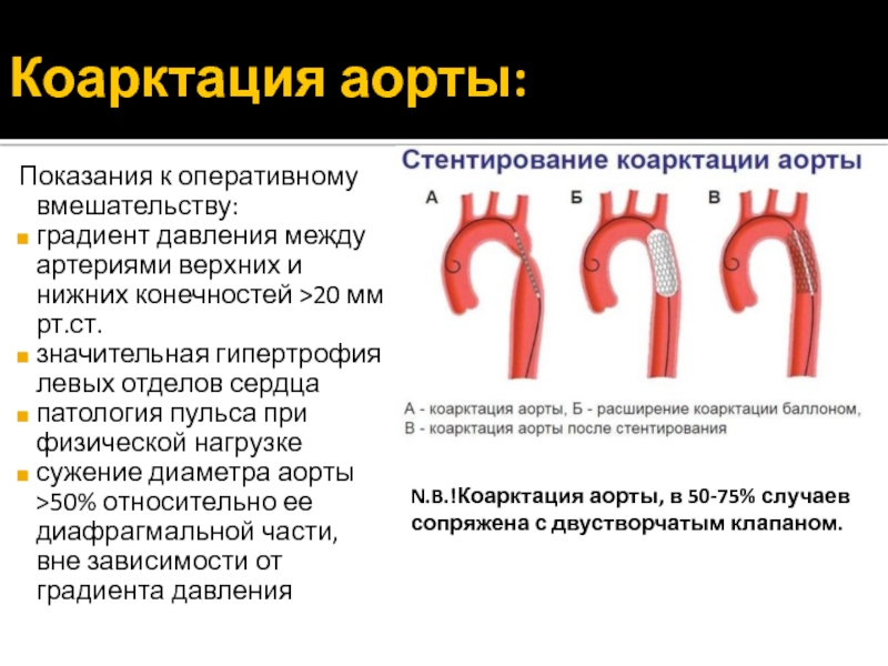 Причины заболевания аорты