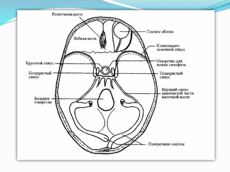 Борозды синусов. Пещеристый синус твердой мозговой оболочки. Пещеристая пазуха анатомия. Боковая стенка пещеристого синуса. Синусы основания черепа.