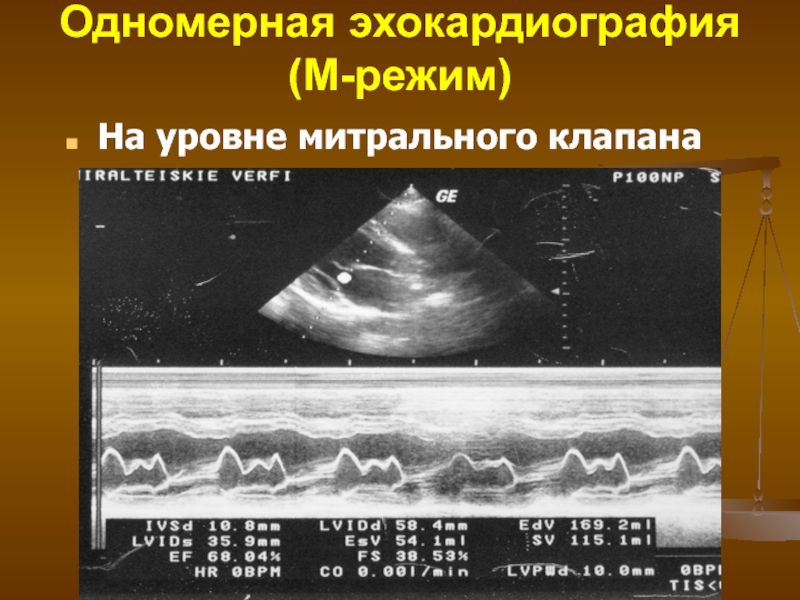 Учебный план эхокардиография