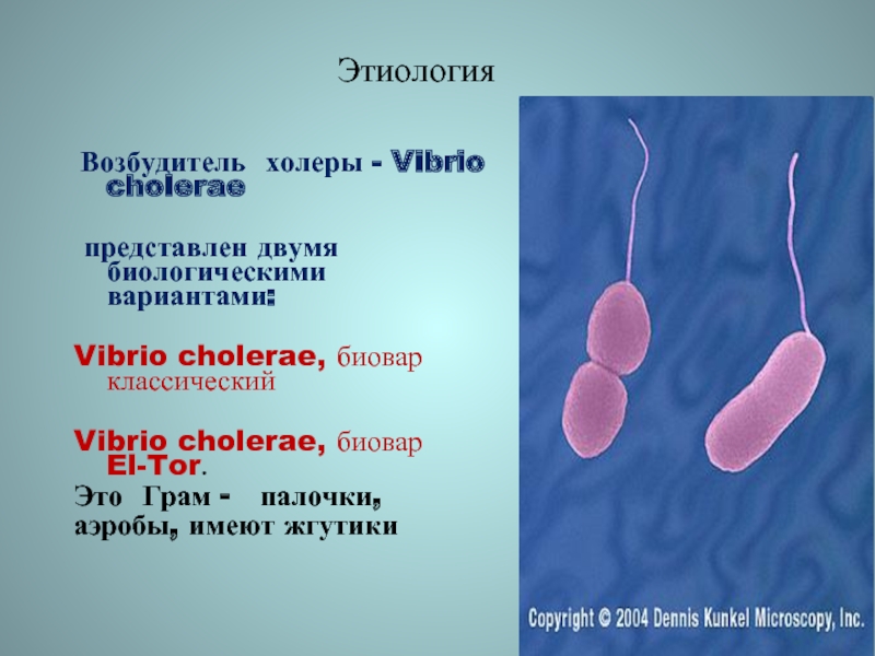 Какой возбудитель холеры. Холерный вибрион микробиология классификация. Холерный вибрион возбудитель холеры.