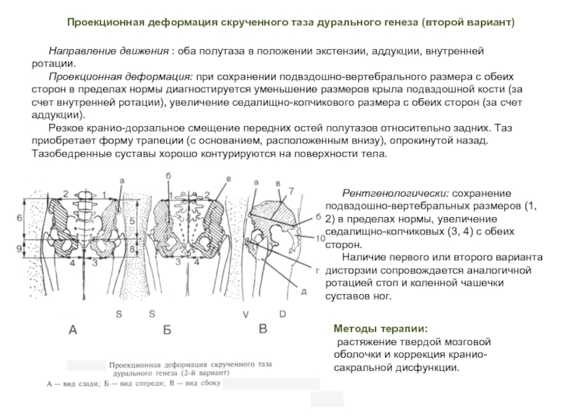 Положение таза. Ротация таза. Деформации тазовых костей. Причины ротации таза. Перекос таза причины.