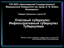 Очаговый туберкулез Инфильтративный туберкулез 