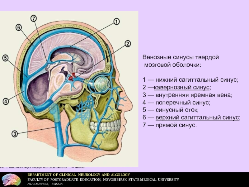Мозговые синусы. Верхний Сагиттальный синус твердой мозговой. Пещеристая пазуха твердой оболочки головного мозга. Венозные пазухи твердой мозговой оболочки. Нижний Сагиттальный синус анатомия.