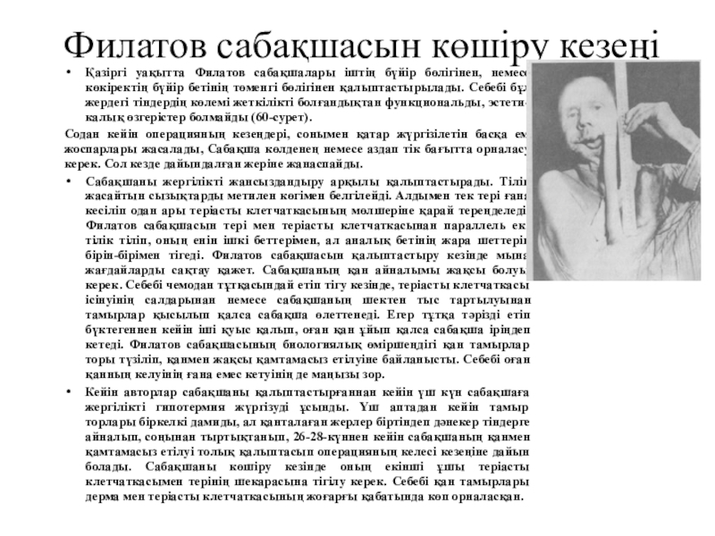Жақ -бет аймағындағы ақаулар мен деформациялар Филатов сабақшасын көшіру кезеңіҚазіргі уақытта Филатов сабақшалары іштің бүйір бөлігінен, Филатов сабақшасын көшіру кезеңіҚазіргі уақытта Филатов сабақшалары іштің бүйір бөлігінен, немесе көкіректің бүйір бетінің төменгі бөлігінен