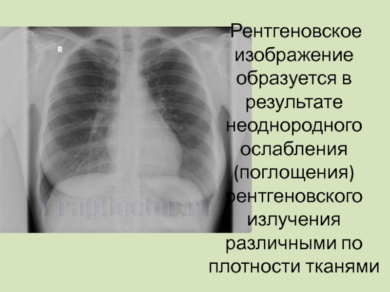 Рентгеновское изображение получают в результате неоднородного