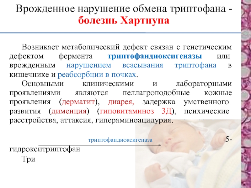 Болезнь хартнупа презентация