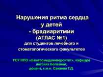 Нарушения ритма сердца у детей - брадиаритмии (АТЛАС №1) для студентов