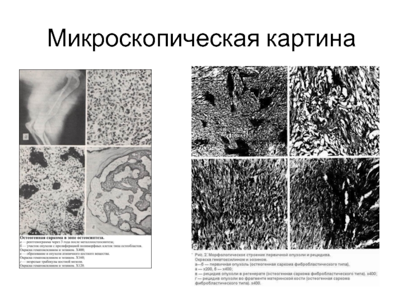 Микроскопическая картина u