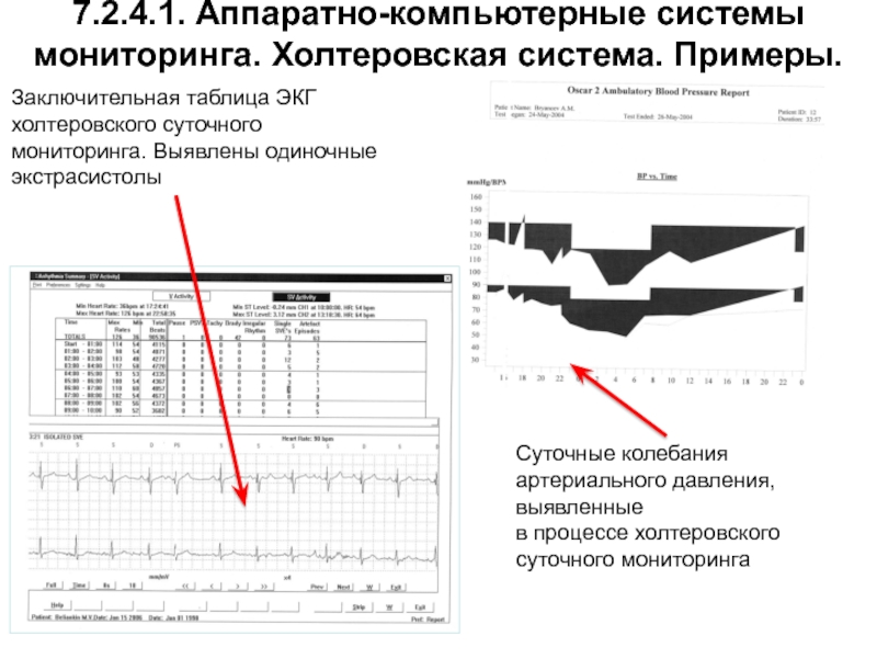 Мониторинг рефераты. Аппаратно-компьютерная экспертиза пример. Программа для мониторинга системы компьютера. Компьютерная система диагностики голоса и речи.