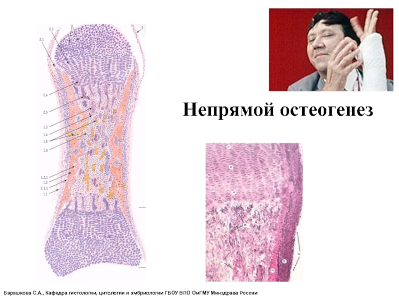 Непрямой остеогенез схема