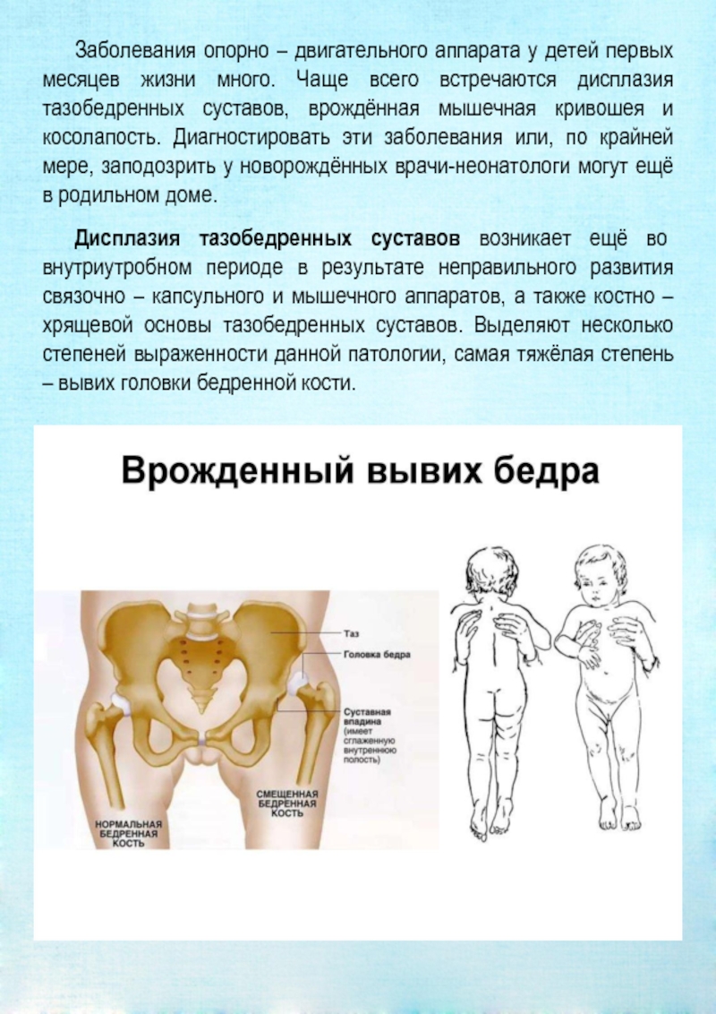 Вывих тазобедренного сустава у взрослых симптомы. Врождённый вывих тазобедренного сустава у детей. Врожденный вывих бедра 1 год. Симптом врожденного вывиха бедра у новорожденных. Врождённый вывих бедра дисплазия.