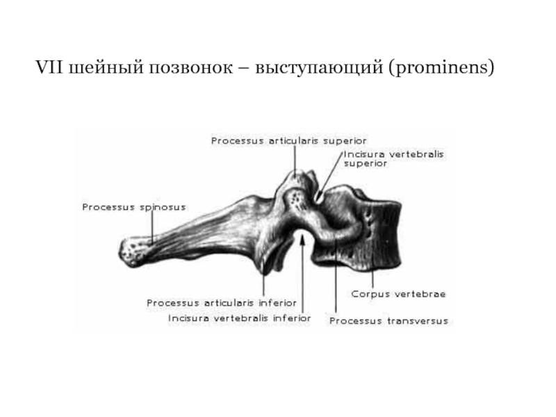 7 шейный позвонок. Седьмой шейный позвонок вид сбоку. Седьмой шейный позвонок строение. Седьмой шейный позвонок на латыни. 6 Шейный позвонок вид сбоку.