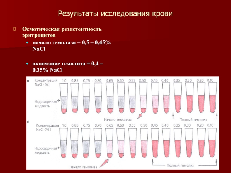 Гемолиз лейкоцитов. Методика исследования осмотической стойкости эритроцитов. Норма осмотической стойкости эритроцитов. Осмотическая резистентность эритроцитов норма. Исследование осмотической резистентности эритроцитов.