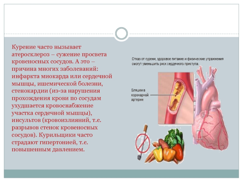 Курил часто. Атеросклероз курильщиков. Влияние курения на атеросклероз. Атеросклероз курение курение. Курение при атеросклерозе сосудов.