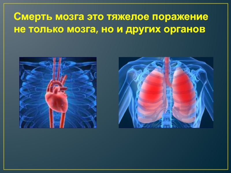 Умерли мозги. Смерть мозга презентация.