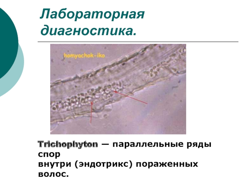 Тип поражения волос endothrix картинка