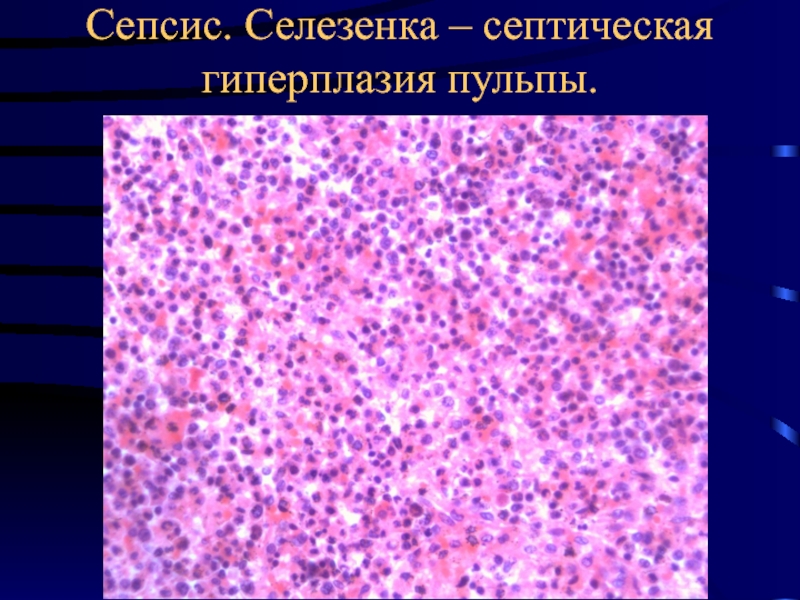 Инфекционные болезни патанатомия презентация