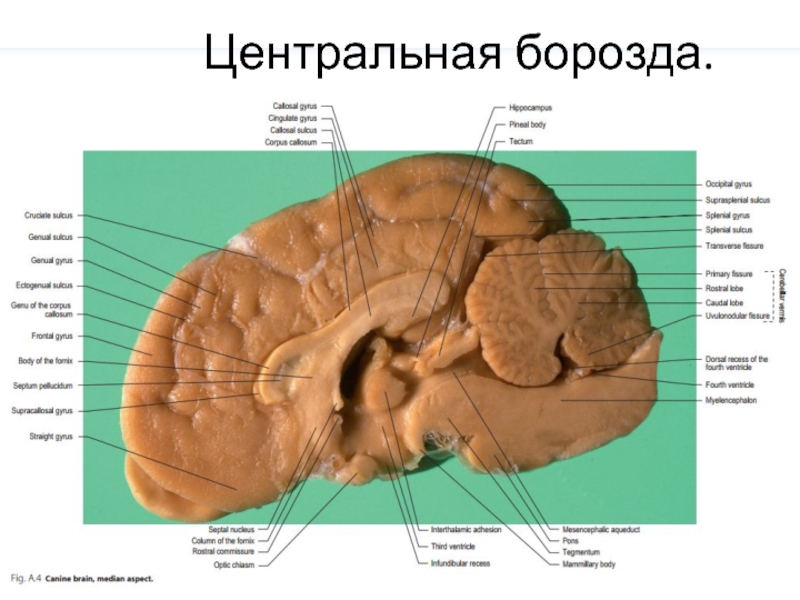 Борозда это. Центральная борозда. Центральная борозда мозга. Задняя Центральная борозда. Около Центральная борозда.