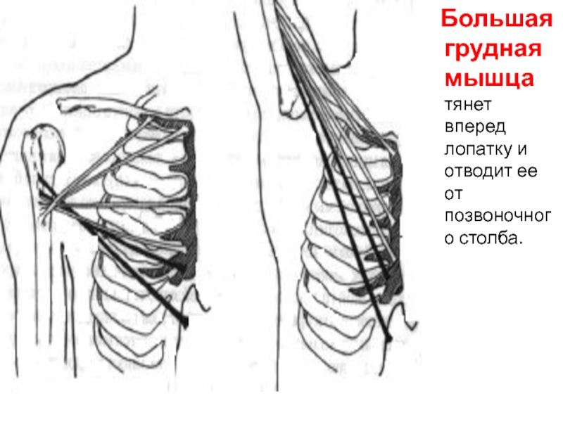 Потянул мышцу лопатки. Большая грудная мышца. Тянет лопатку вверх малая грудная. Большой грудной сегменты. Тянуть вперед.