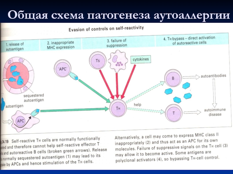 Схема патогенеза аутоиммунных заболеваний