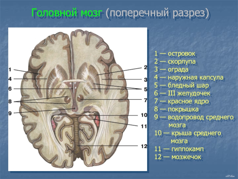 Поперечный разрез головного мозга рисунок с подписями