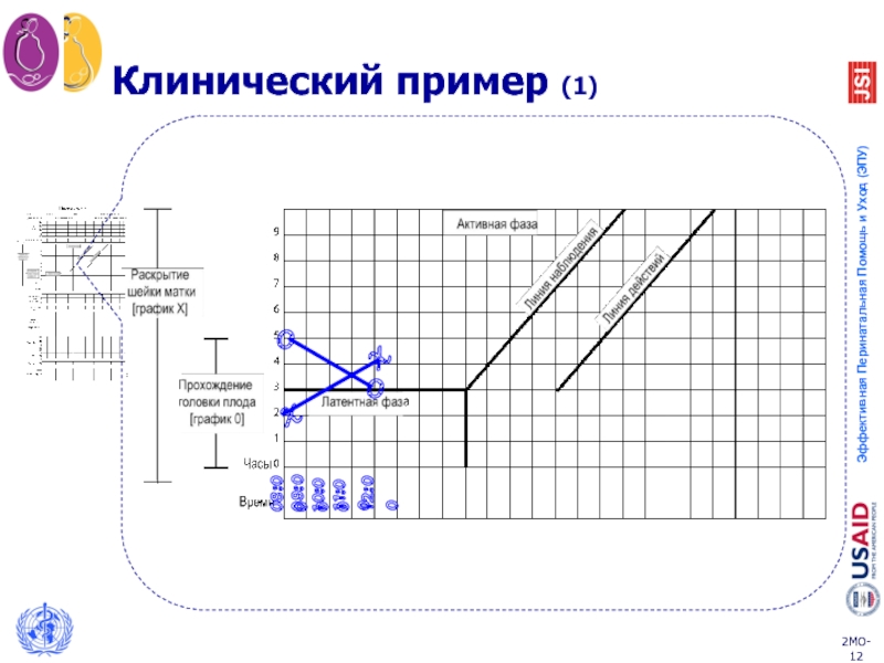 Партограмма в акушерстве образец