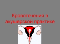 Кровотечения в акушерстве 