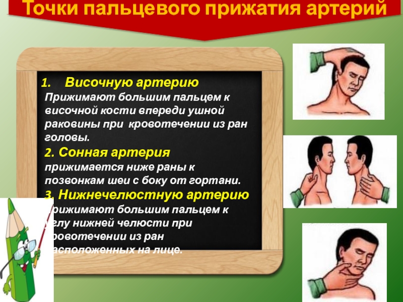 Остановить кровотечение на сонной артерии ответ тест. Прижатие височной артерии. При кровотечении Сонная артерия прижимается к. Пальцевое прижатие височной артерии. Место пальцевого прижатия сонной артерии.