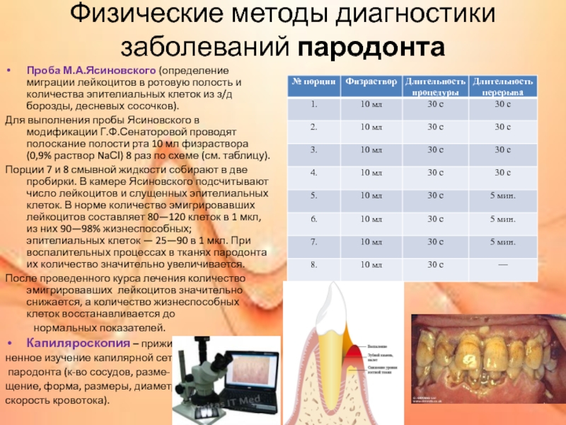 Методы обследования больных с заболеваниями пародонта презентация