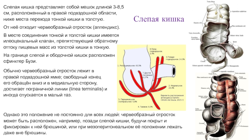 Низкое положение слепой кишки что это такое