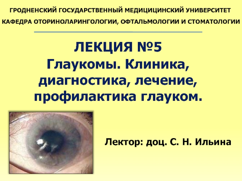 Презентация Глаукомы. Клиника, диагностика, лечение, профилактика глауком