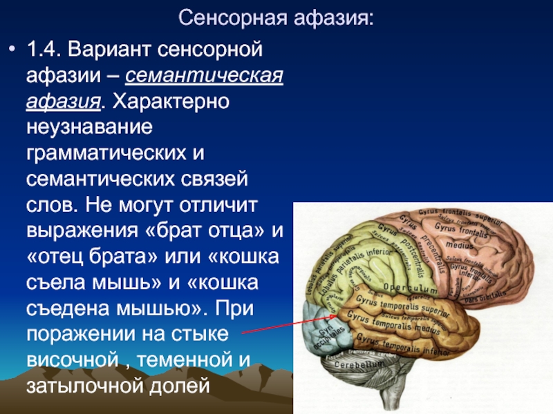 Сенсорная афазия. Очаг поражения при амнестической афазии. Семантическая и сенсорная афазия. Поражение мозга при сенсорной афазии. Семантическая афазия локализация.