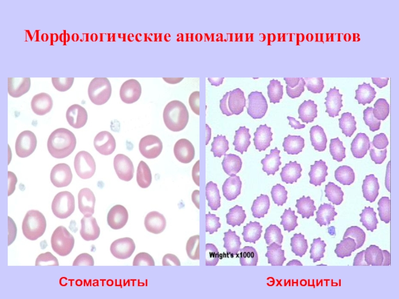 Если на эритроцитах обнаружен только антиген в исследуемый образец крови относится к группе тест