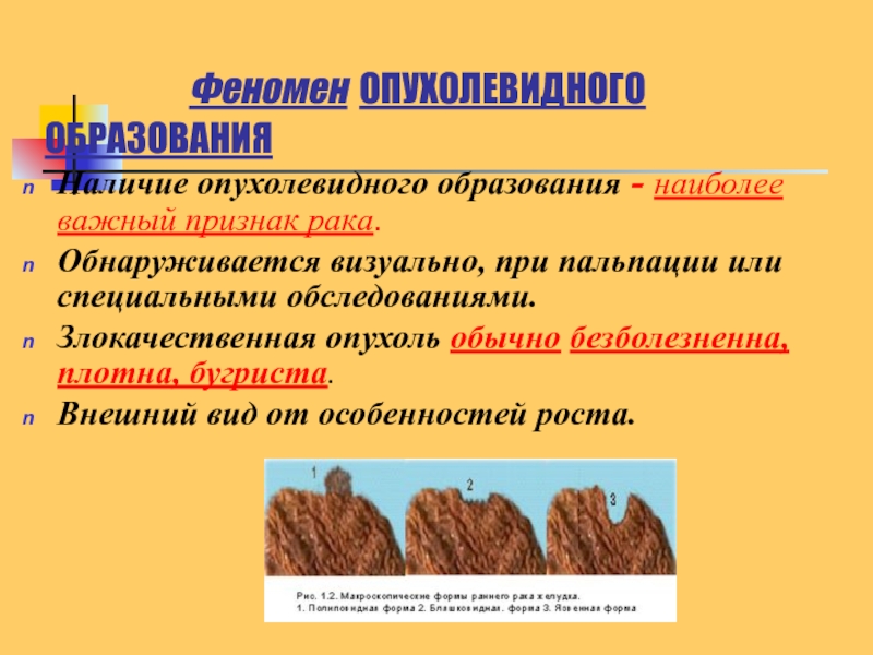 Наличие образоваться. Феномен опухолевидного образования. Феномен опухолевидного образования фото. Опухолевидного безболезненного образования.