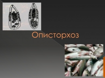 Описторхоз