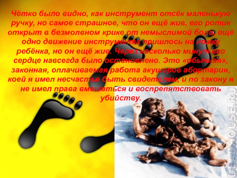Всё о абортах… Чётко было видно, как инструмент отсёк маленькую ручку, но самое страшное, Чётко было видно, как инструмент отсёк маленькую ручку, но самое страшное, что он ещё жив, его ротик
