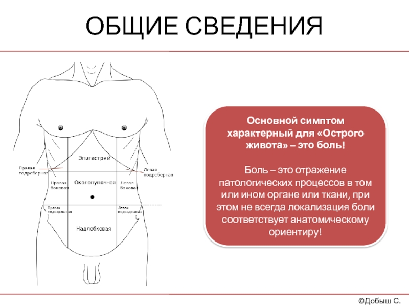 Картина острого живота