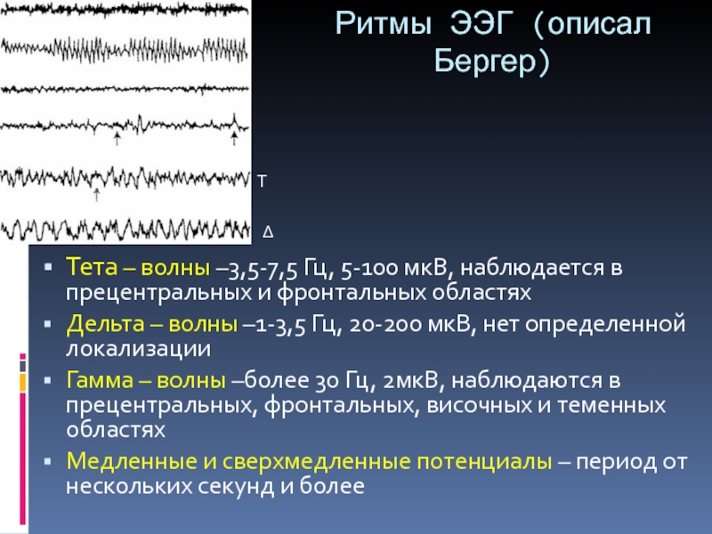 Дельта волны. Тета волны на ЭЭГ. Дельта волны на ЭЭГ. Вспышки Дельта волн на ЭЭГ. Бергер ЭЭГ.