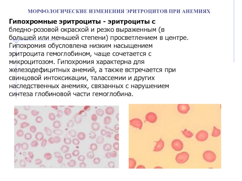 Морфологические изменения в эритроцитах рисунок