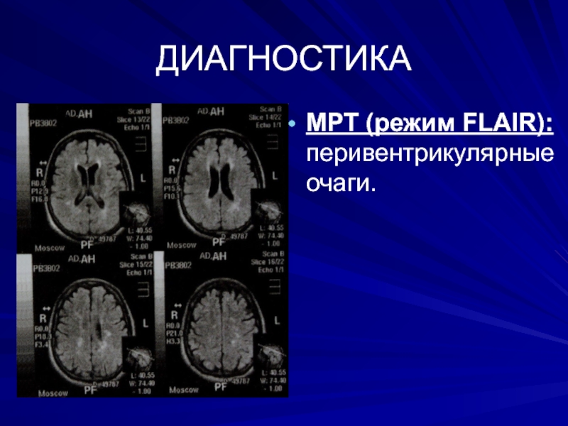 Режимы мрт презентация