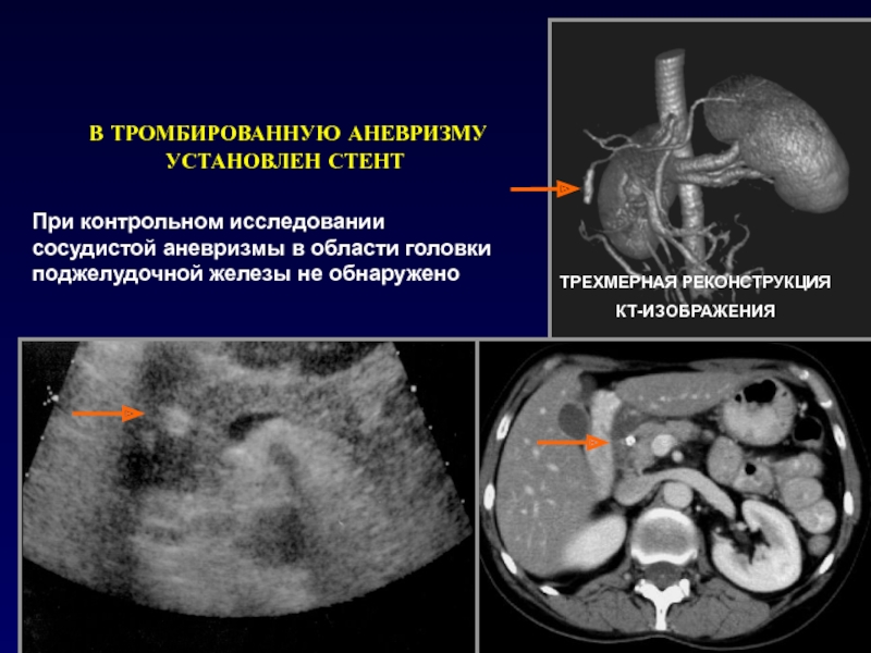 Итеративная реконструкция кт изображений