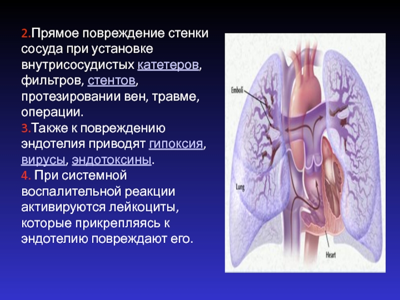 Повреждение стенок. Тромбофилия профилатк. Сосуды при системной воспалительной реакции. Презентация по теме тромбофилия.