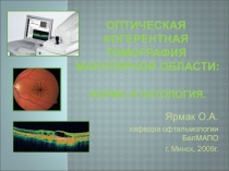 ОПТИЧЕСКАЯ КОГЕРЕНТНАЯ ТОМОГРАФИЯ МАКУЛЯРНОЙ ОБЛАСТИ: НОРМА И ПАТОЛОГИЯ