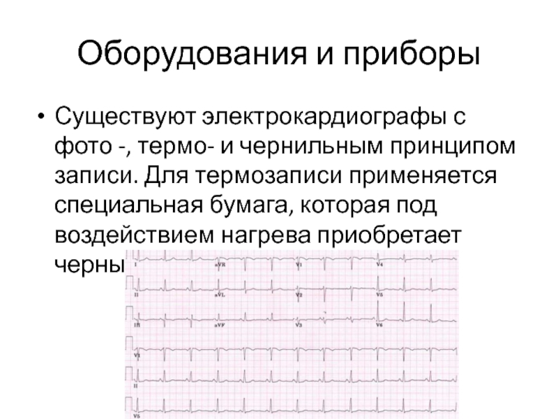 Записывать принципы